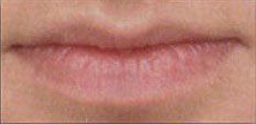 Woman permanent lip makeup before — Oklahoma City, OK — Permanent Makeup by Kim Warren