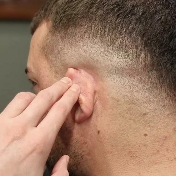 Hand Touching Ear With Short Fade Haircut — Bolton Brothers Barbers in Erina, NSW