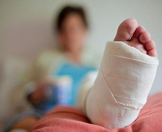 Broken Leg — Lake City, FL — Lloyd E. Peterson Jr., Sandra H. Peterson, Attorneys At Law Broken Leg — Lake City, FL — Lloyd E. Peterson Jr., Sandra H. Peterson, Attorneys At Law