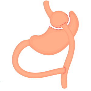 Pink/orange stomach anatomy icon with esophagus and intestines on a white background