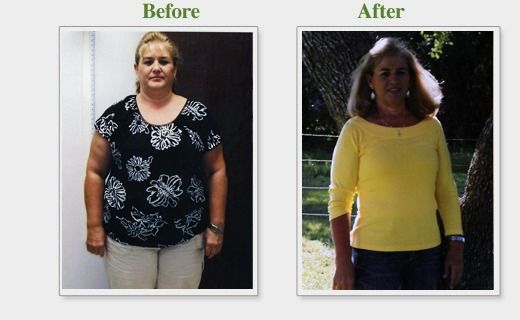 Side-by-side “Before” and “After” photos of a woman showing weight loss, wearing black then yellow tops.