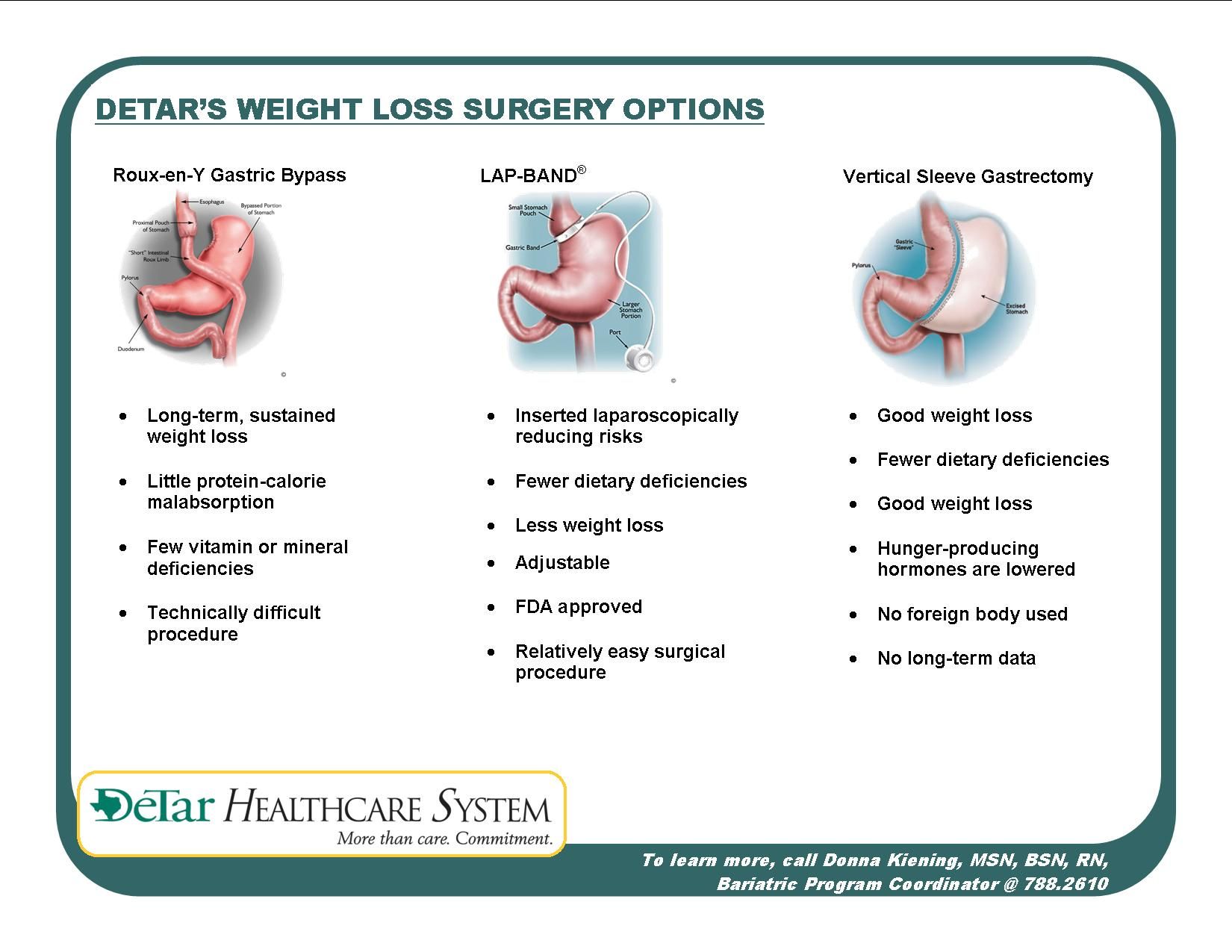 Chart comparing weight loss surgery options with stomach diagrams and bullet points on a white, teal-bordered flyer