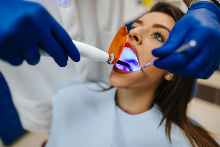 cure canalari