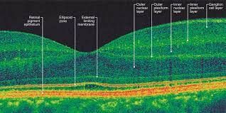 Eye Disease — Male Patient in Ophthalmology Clinic in Lawton, OK Eye Disease — Male Patient in Ophthalmology Clinic in Lawton, OK