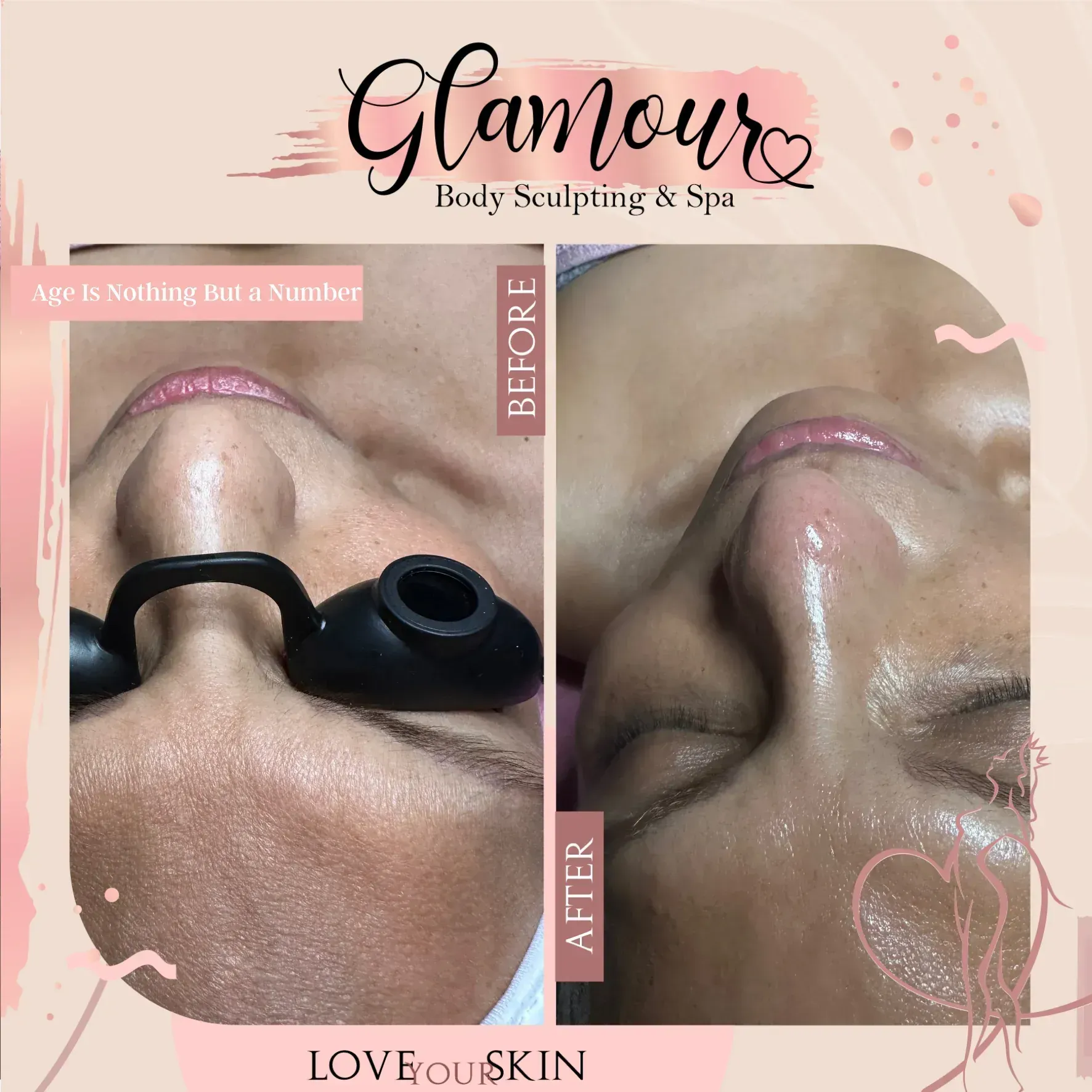 Glamour Spa facial,