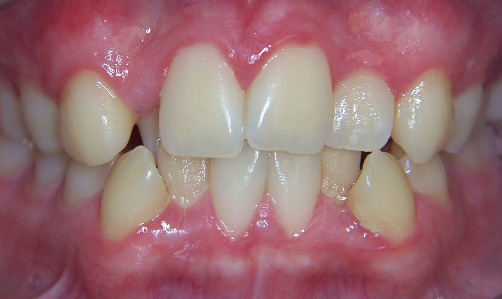 Galleries, Office Gallery & Smile Gallery in Hempstead, Country Smiles