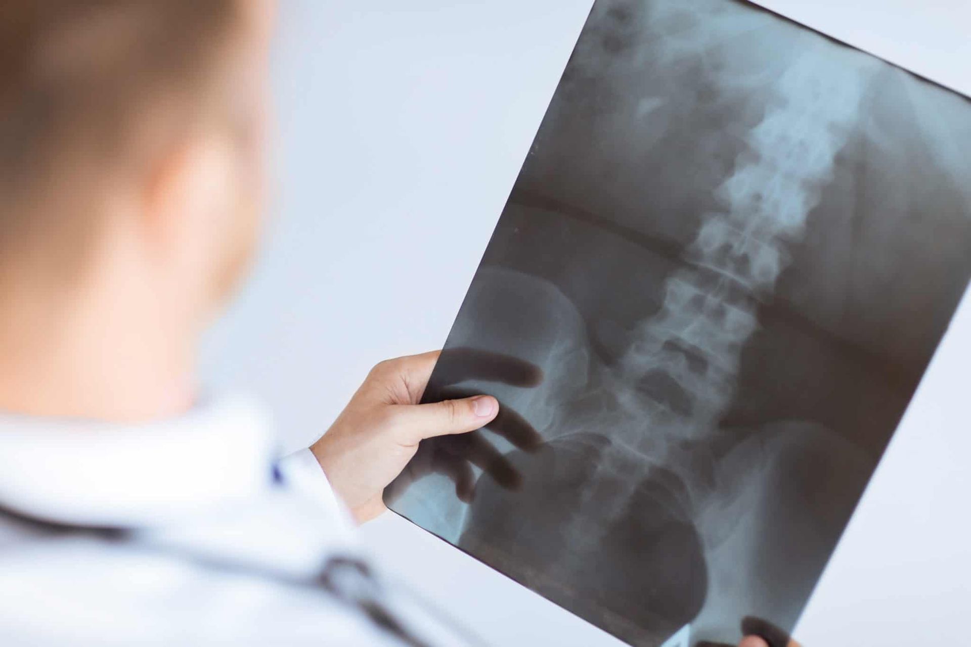 x-ray