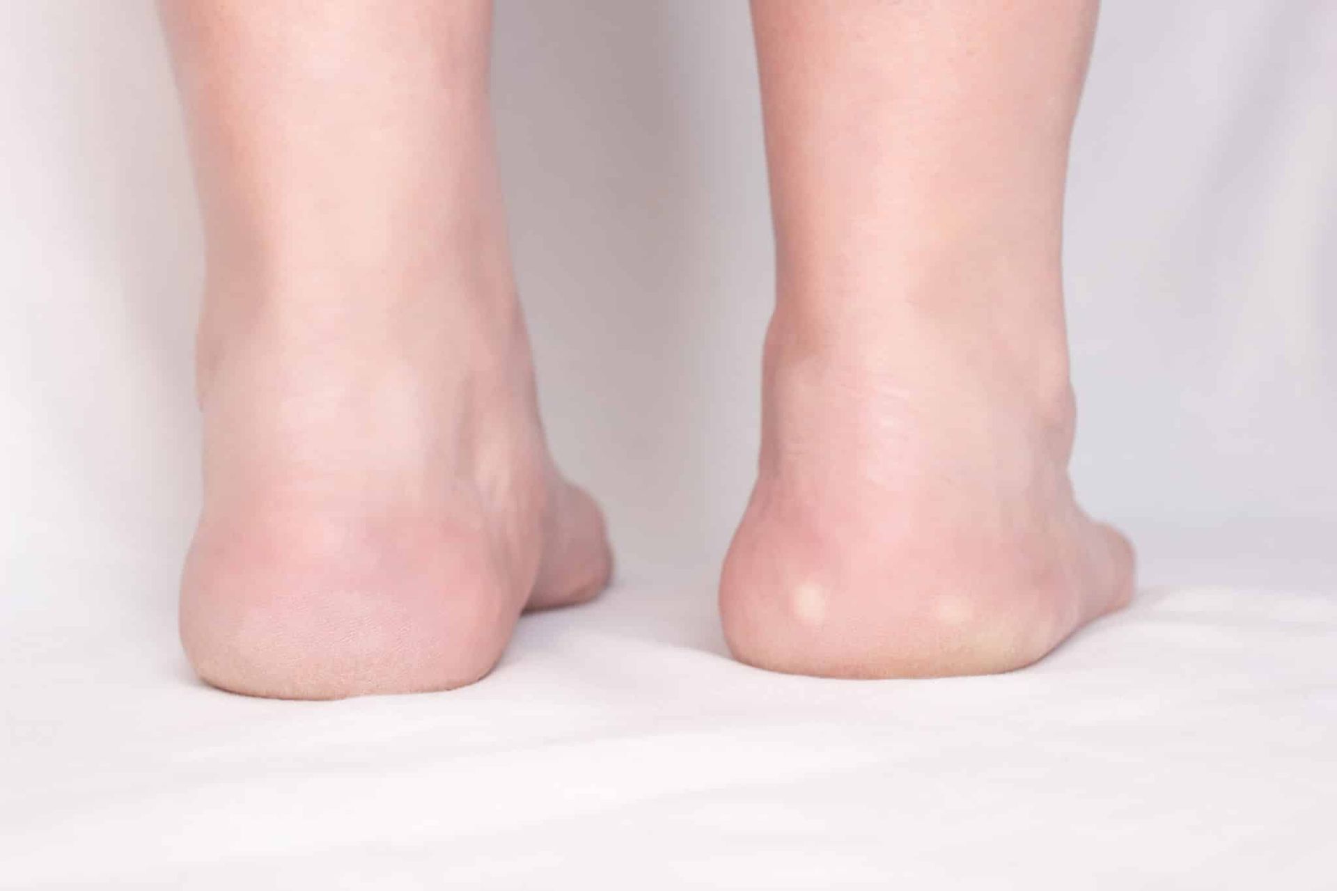 feet
