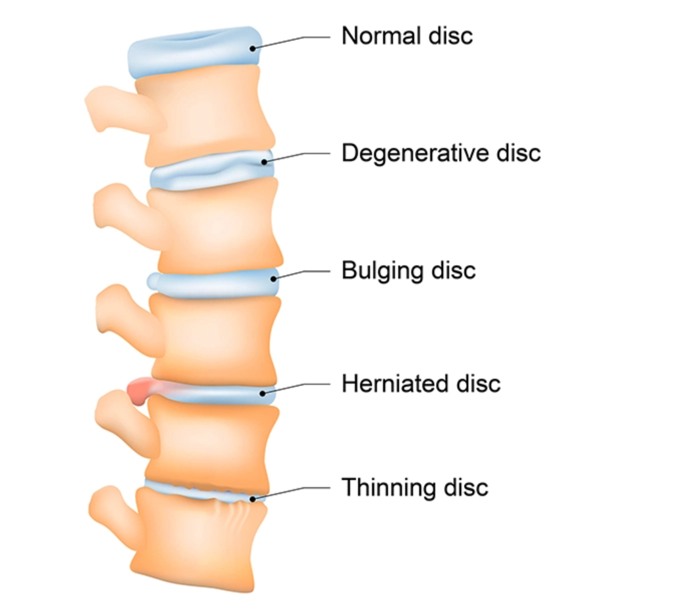 spine