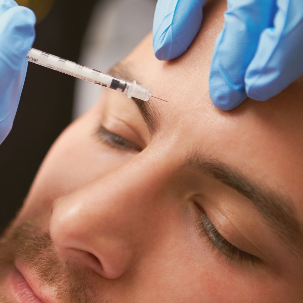 Migraine neurotoxin injection treatment