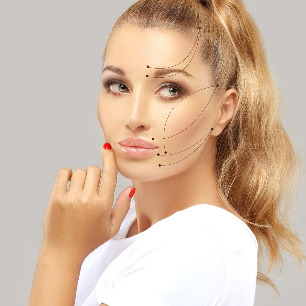 Facial thread lifting results at Superior Health Medical