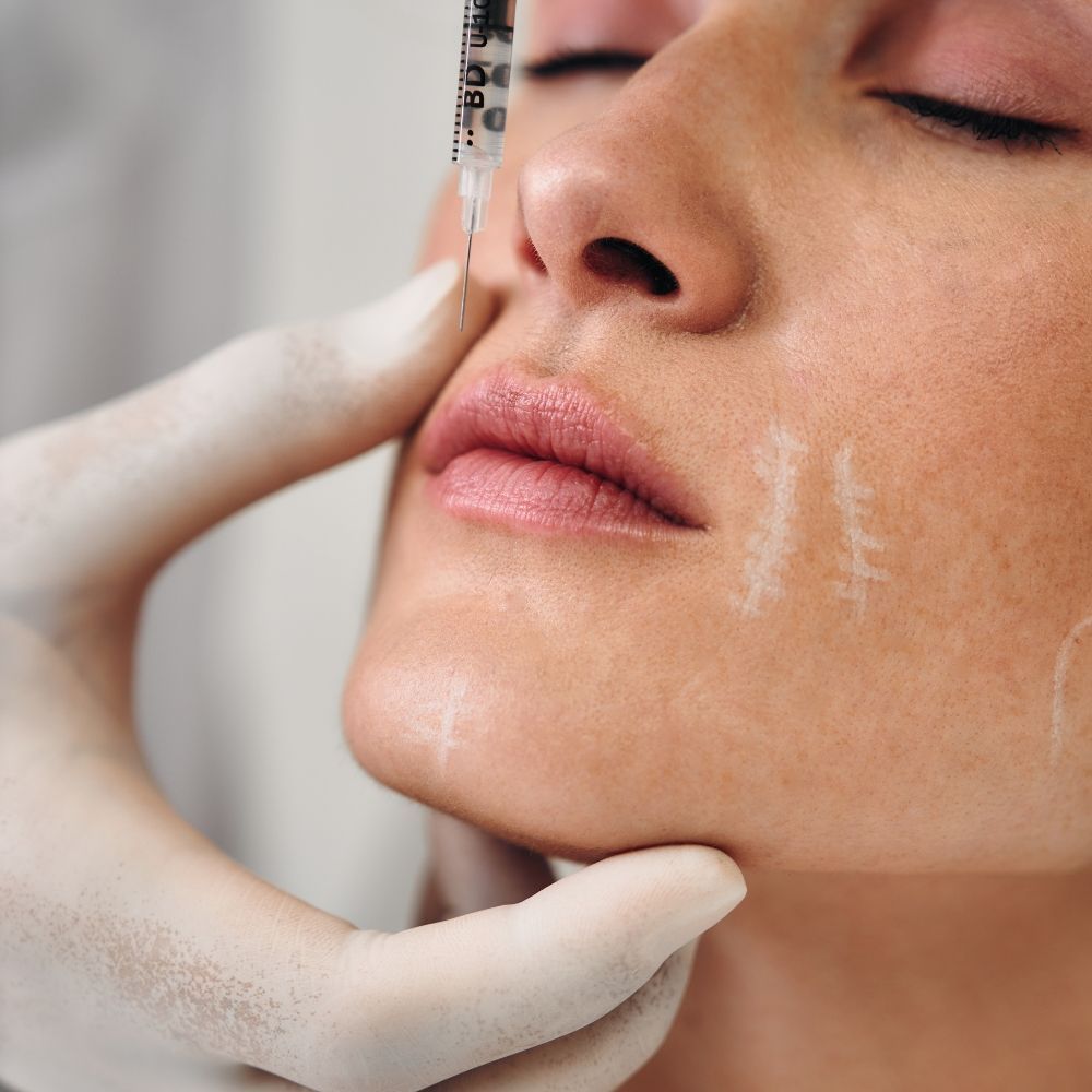 Facial contouring at Superior Health Medical and Wellness