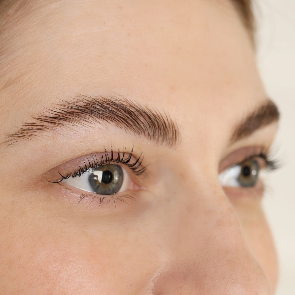 Brow lift treatment experience at Superior Health Medical