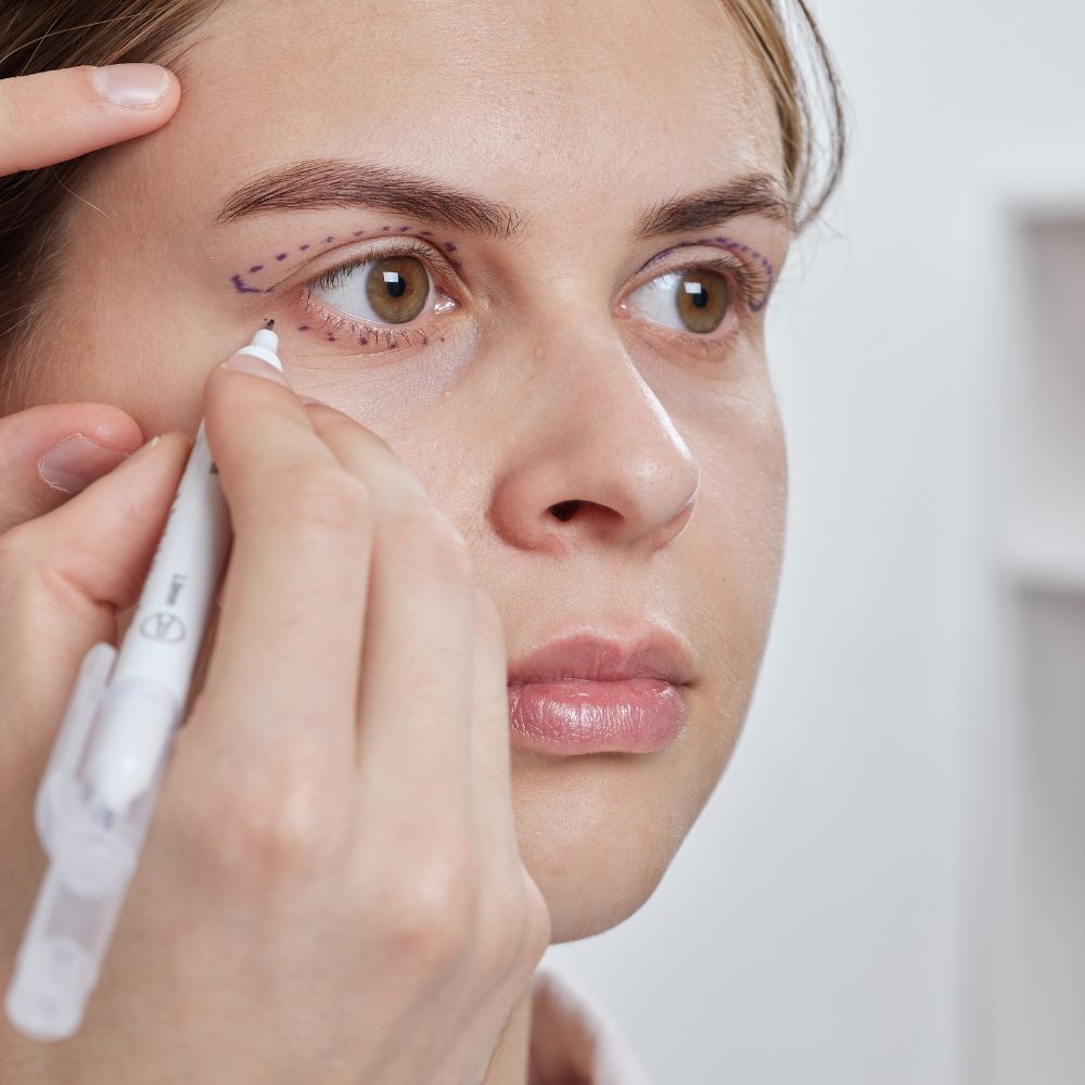 Non-surgical vs surgical blepharoplasty at Superior Health Medical