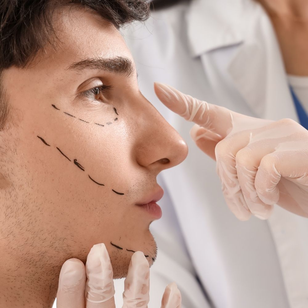 Recovery after non-surgical blepharoplasty at Superior Health Medical