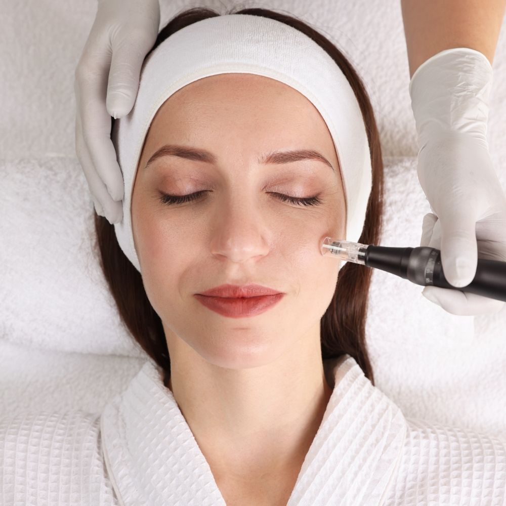 Microneedling results at Superior Health Medical
