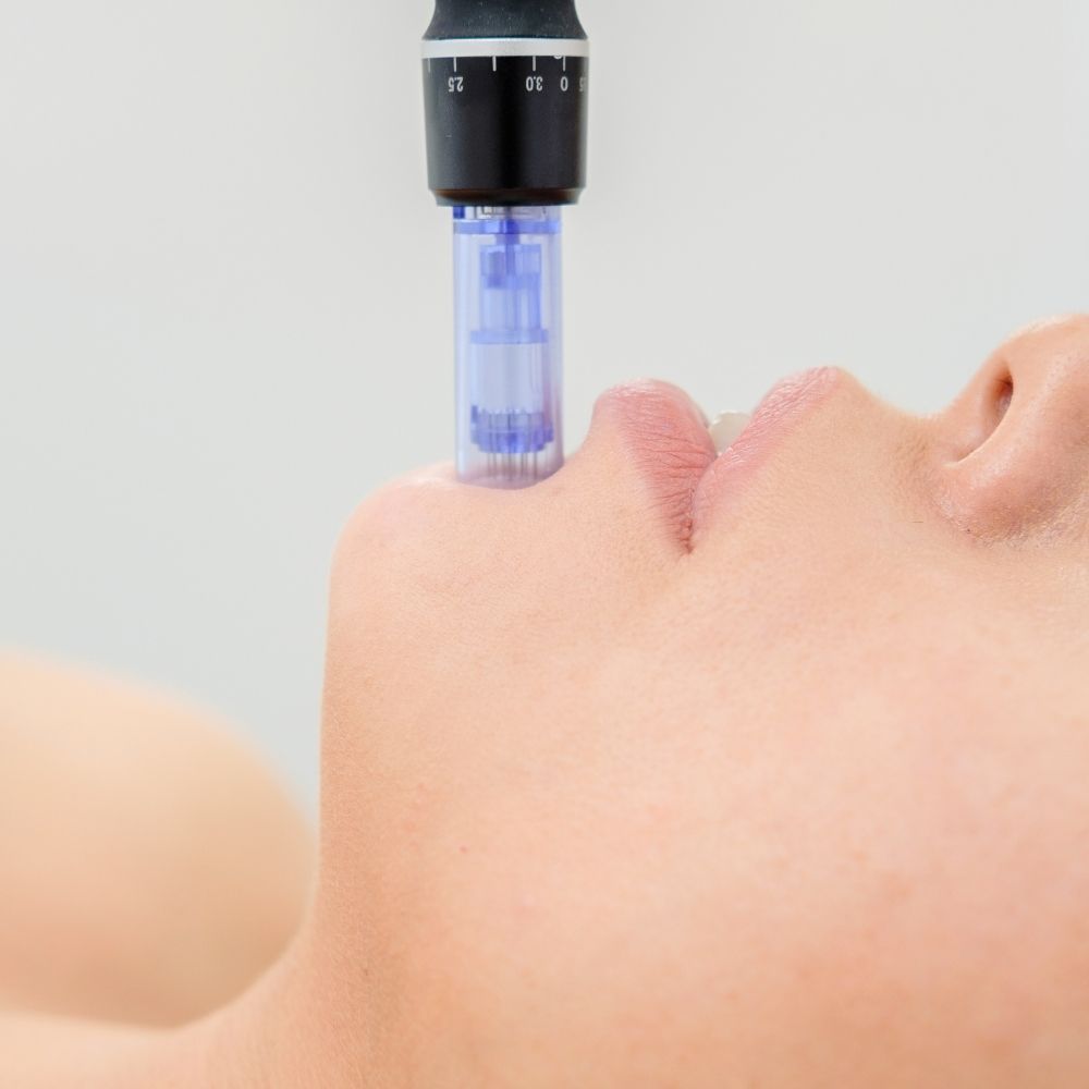 Microneedling collagen science at Superior Health Medical