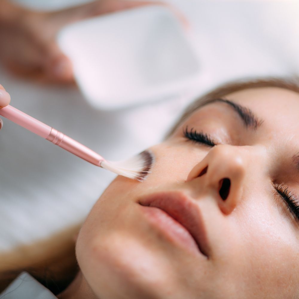 Chemical peel types and science at Superior Health Medical