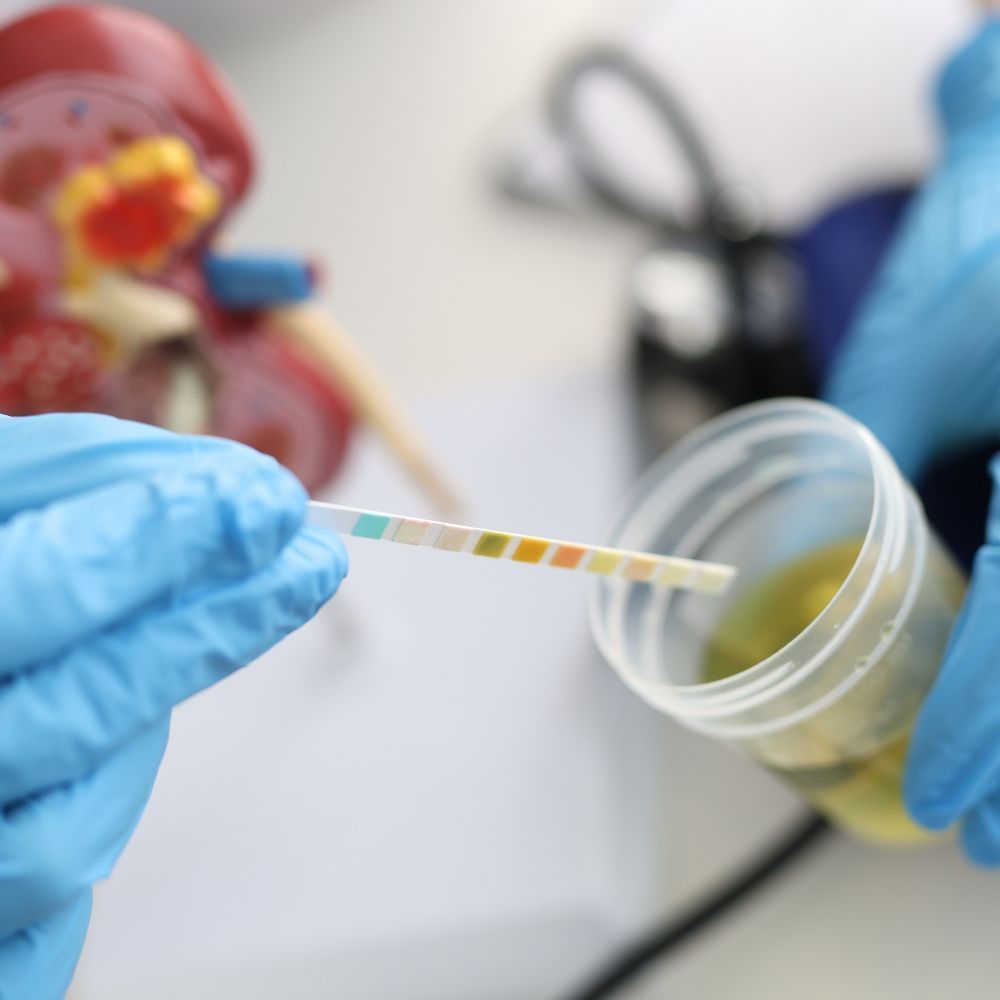 Urinary tract infection diagnosis and evaluation