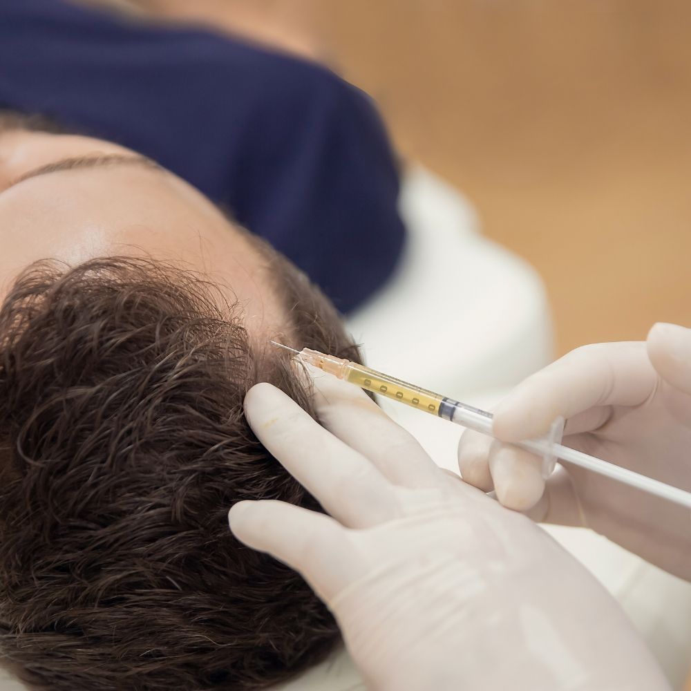 PRP hair loss treatment for men at Superior Health Medical and Wellness