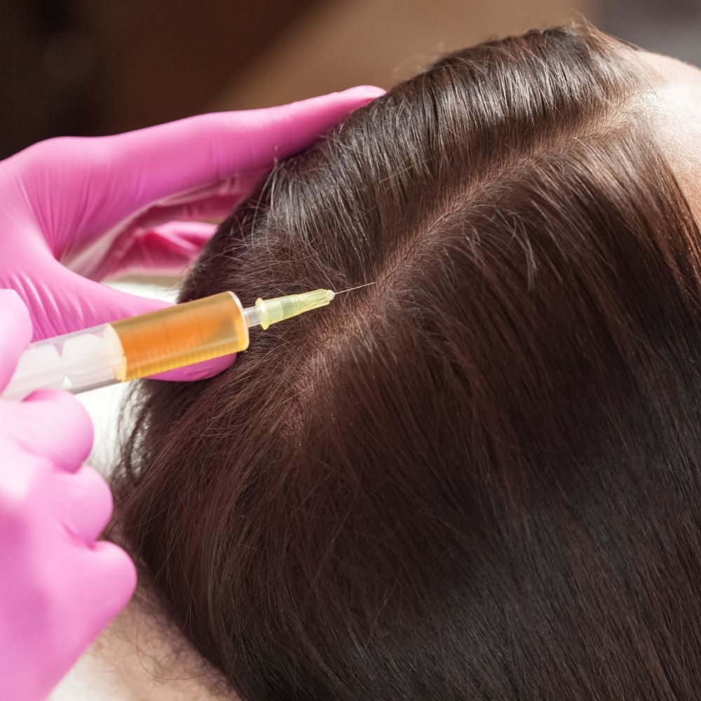 PRP hair loss treatment for women at Superior Health Medical and Wellness