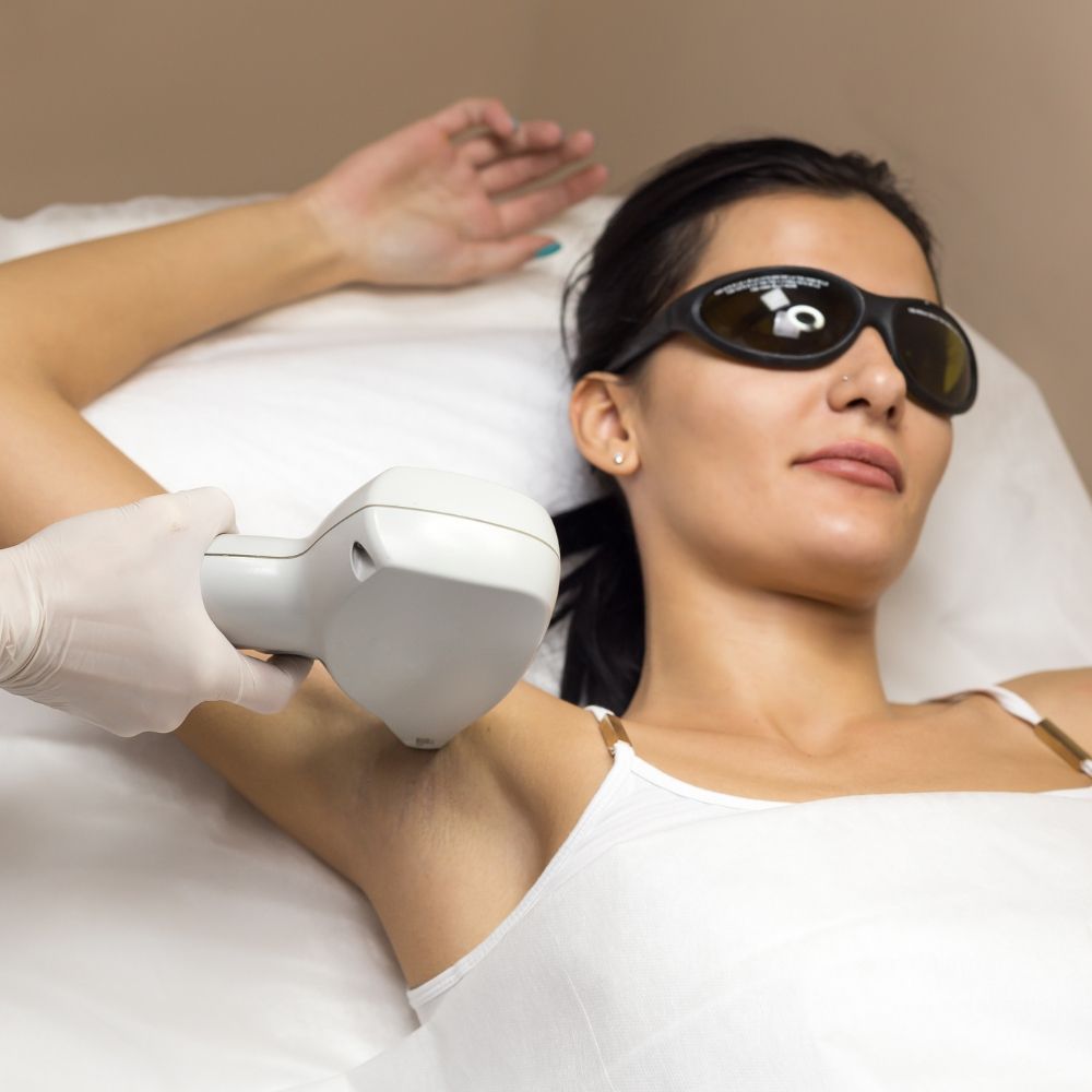 Laser hair removal treatment