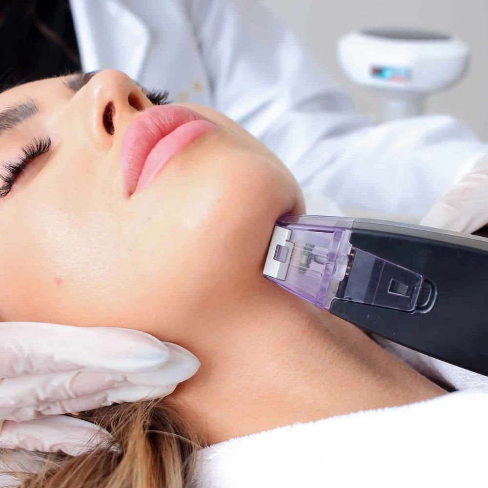 Morpheus8 body contouring treatment