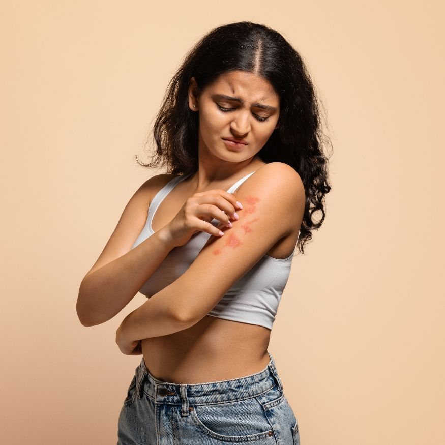 Skin Infections & Rashes