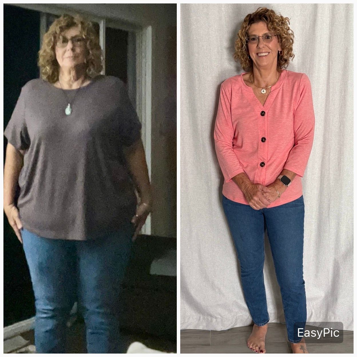 Before and after medical weight management result