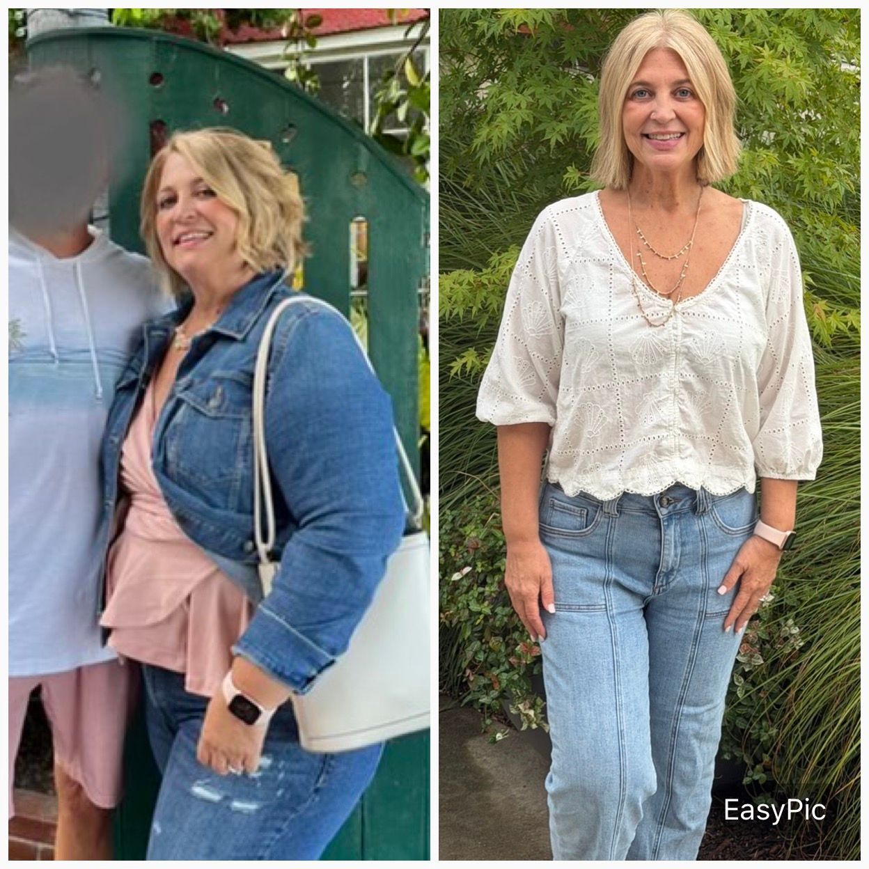 Before and after medical weight management result
