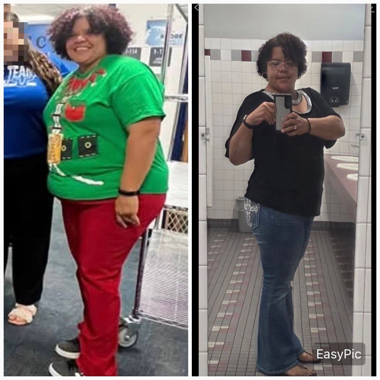 Before and after medical weight management result