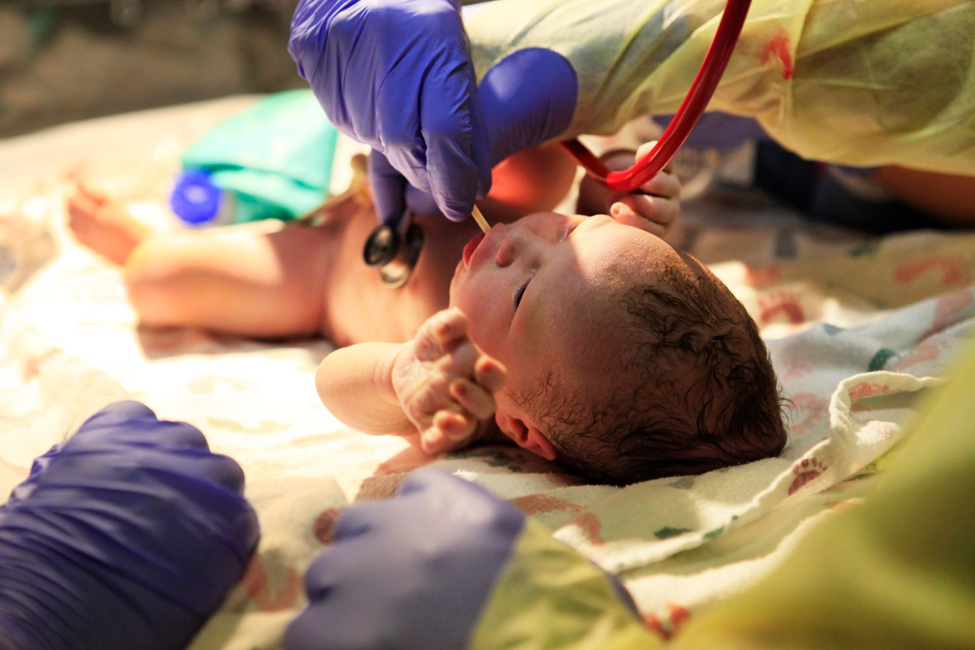 Fetal monitoring failures