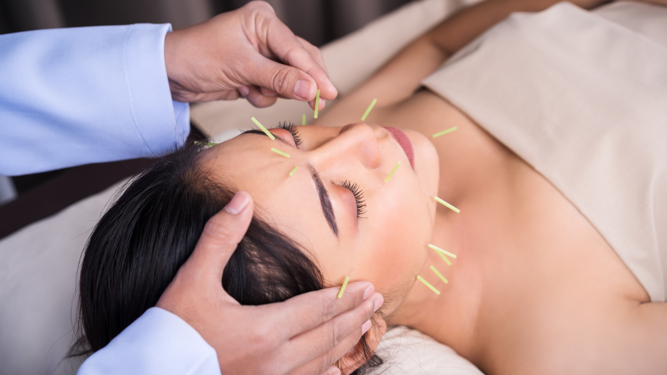 A woman is getting an acupuncture treatment on her face.