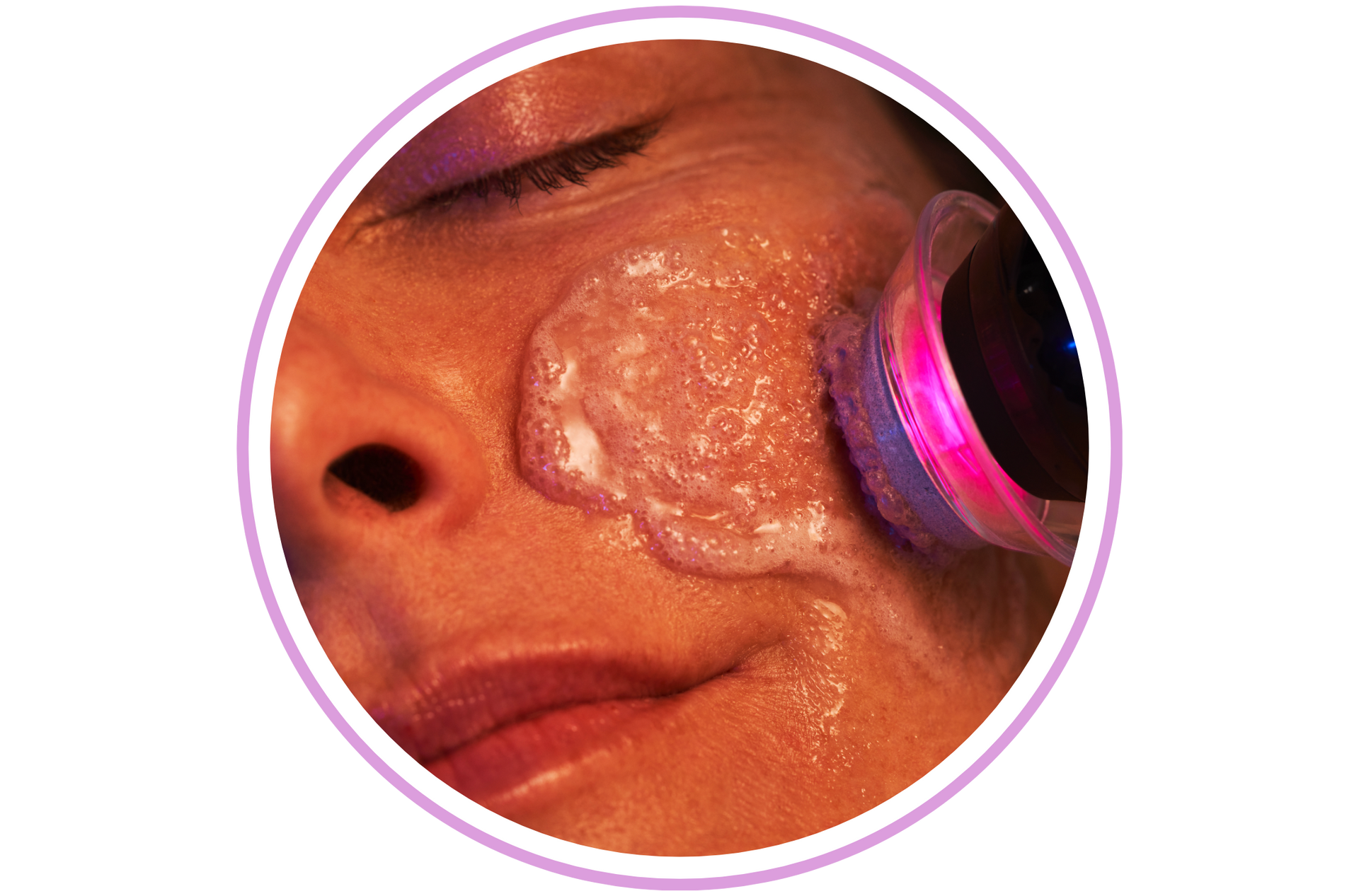 Woman's face being treated with glowing skincare device; soap on face, eyes closed.