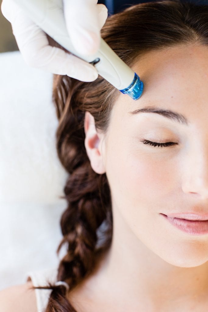 A woman is getting a hydrafacial treatment on her forehead at Results Skincare Studio in Fort Myers