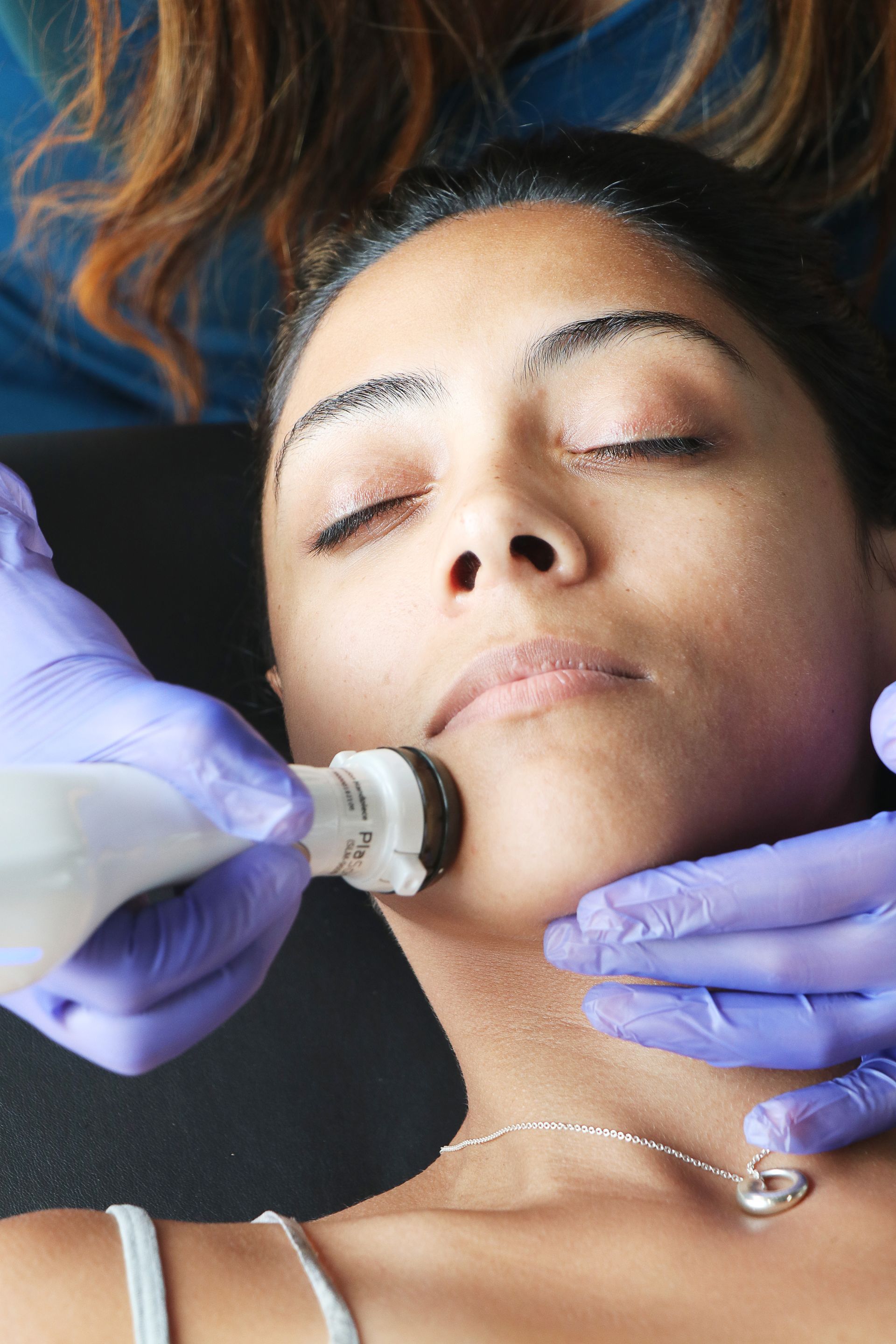 A woman is getting an acne facial treatment at Results Skincare Studio in Fort Myers