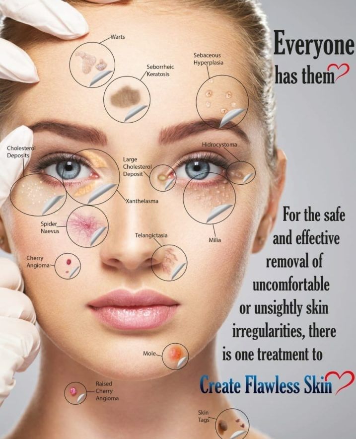 A woman 's face is shown with the words everyone has them