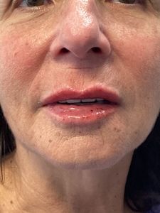 Close-up of a person’s mouth and lower face with natural makeup and light pink lipstick
