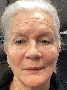 Close-up of a person with white hair and a neutral expression against a dark background