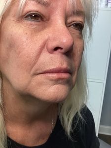 Close-up of a woman’s face in profile, wearing a black shirt, with a neutral expression indoors.
