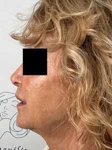 Side profile of a person with curly blonde hair, facing left against a white background.