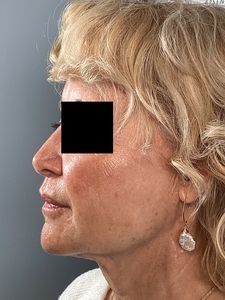 Profile view of a blonde person wearing earrings against a gray background