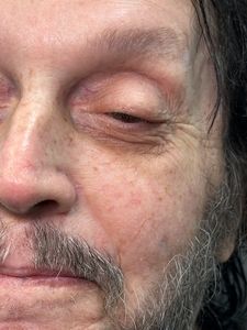 Close-up of a tired face with one eye closed and a gray beard.
