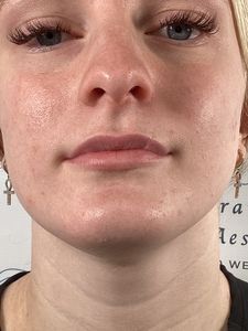 Close-up portrait of a person with a neutral expression wearing earrings against a light background.