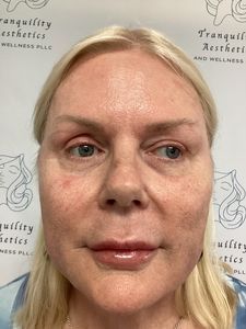 Close-up of a woman with blonde hair against a branded wellness clinic backdrop.