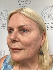 Close-up of a blonde woman in profile against a clinic-branded backdrop