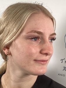 Close-up side profile of a blond person looking right, with a neutral expression against a white background.