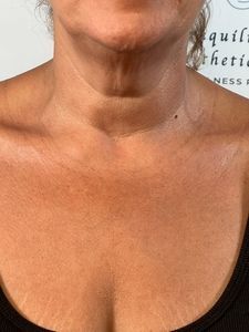 Close-up of a person’s neck and upper chest wearing a black V-neck top.