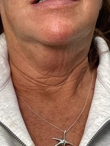 Close-up of a person wearing a white zip-up top and starfish pendant necklace