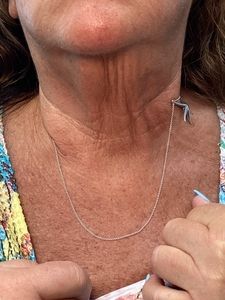 Close-up of a neck and chest wearing a delicate silver necklace with a small pendant.